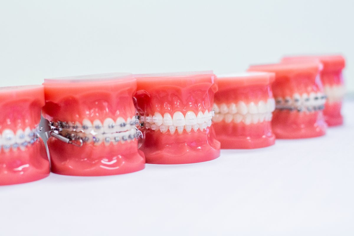 Is Orthodontic Retreatment Right for You